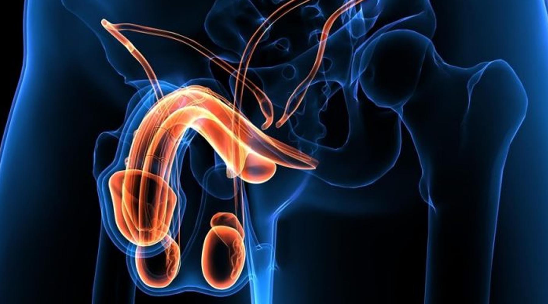 Dr. Jairo Domínguez tratamiento de cáncer de testículo