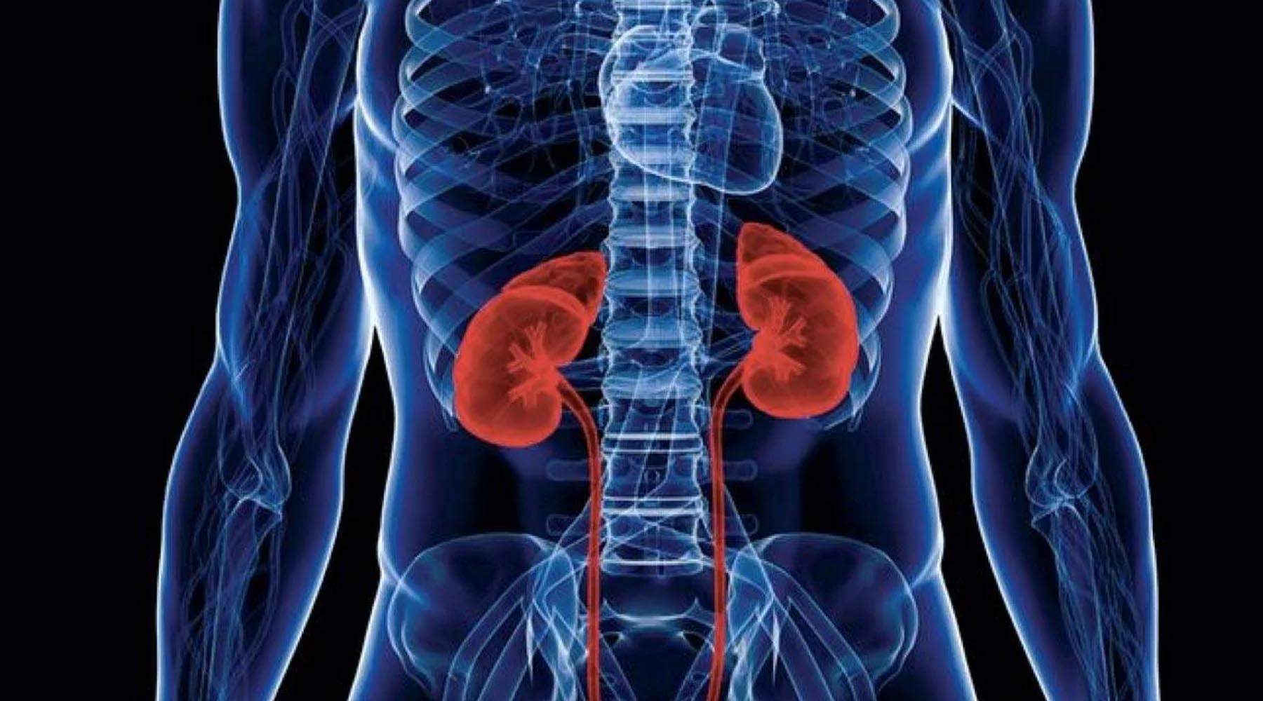 Dr. Jairo Domínguez tratamiento de cáncer de riñón