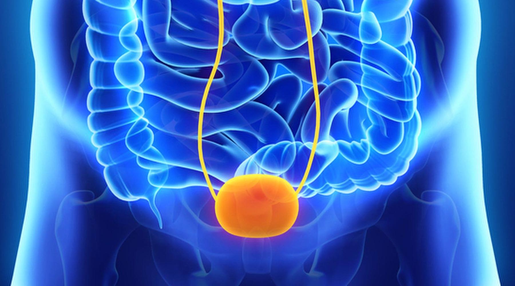 Dr. Jairo Domínguez tratamiento de cáncer de vejiga